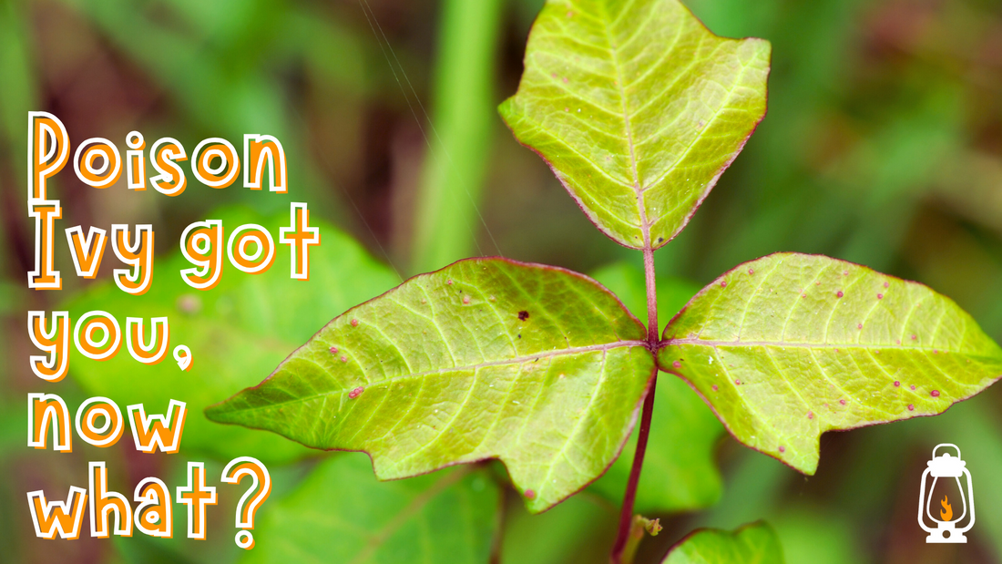 Do you know how to treat Poison Ivy: Blog Post